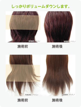 ビフォーアフター